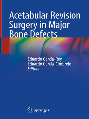 cover image of Acetabular Revision Surgery in Major Bone Defects